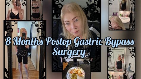 Months Postop Update Gastric Bypass Surgery Trigger Warning Youtube