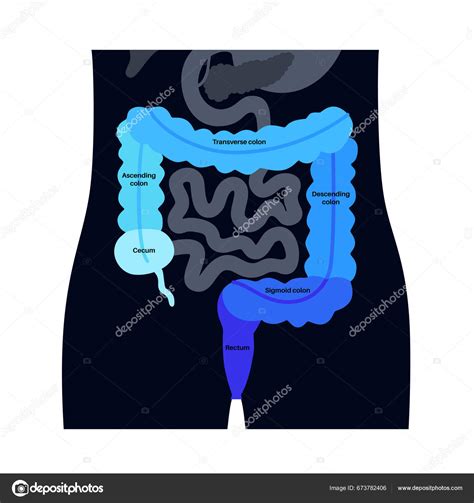 Cartaz Anatómico Intestino Grosso Secções Intestino Humano Exame