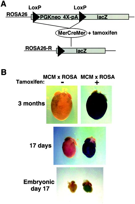 Temporally Regulated And Tissue Specific Gene Manipulations In The