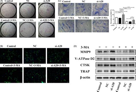 A Inhibits Osteoclastogenesis Through Downregulating Autophagy Under