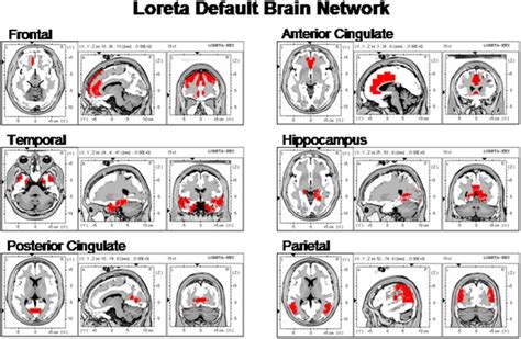 The Locations Of The Six Default Mode Networks As Summarized By Buckner Download Scientific