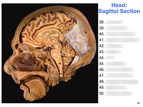 Head Sagittal Section Diagram Quizlet