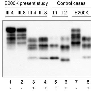 Western Blot Analysis Brain Homogenates Obtained From The Frontal