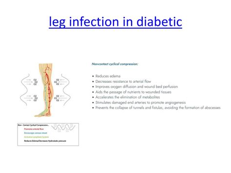 Ppt Hyper Chamber Diabetic Foot Ulcer Wound Care Leg