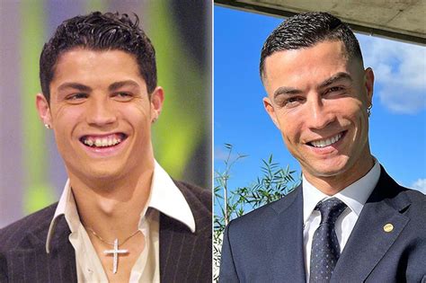 Antes E Depois Vejam Como Eram Essas Celebridades Antes Dos