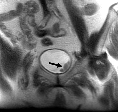 Mr Urography Techniques And Clinical Applications Radiographics