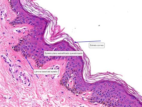 Plano Estratificado No Queratinizado Hot Sex Picture