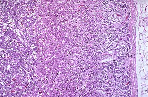 Endocrine Pathology