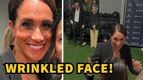 The Aged And Wrinkled Face Of Meghan Markle Has Shocked Fans Due To Its