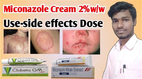 Miconazole Nitrate Cream Ip 2 W W Uses In Hindi DK Gel Micogel