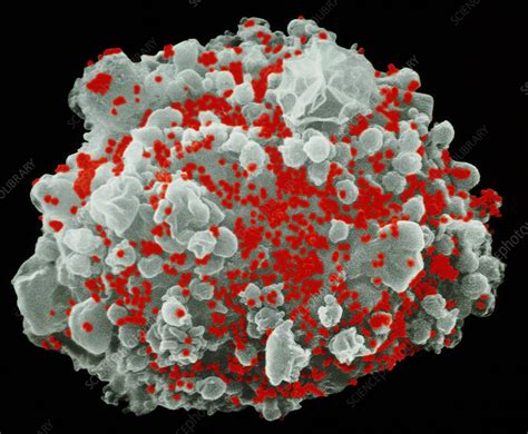 Sem Of T Cell Infected With Hiv Stock Image M0500746 Science