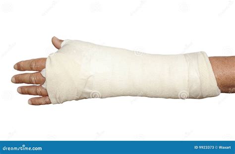 Left Arm In White Bandage And Cast Stock Image Image Of Gauze Broken