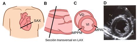 Vista De Eje Corto Paraesternal En El Plano Papilar Labster