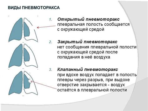 Форма грудной клетки при заболеваниях бронхолегочной системы - online ...