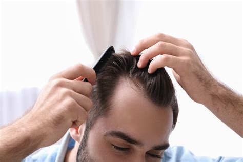 Hair Restoration Cost Financial Guide To Hair Loss Solutions