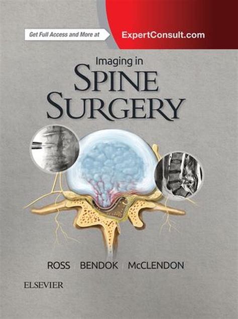 Imaging In Spine Surgery Ebook Bernard R Bendock Md Faans