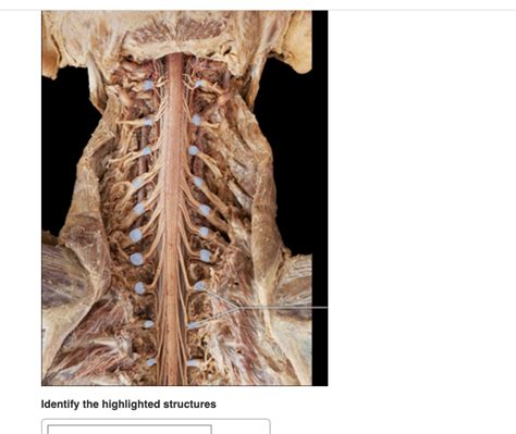 Solved Identify The Highlighted Structures Chegg