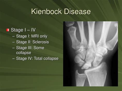 Ppt Hand And Wrist Injuries Powerpoint Presentation Free Download Id4108470