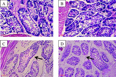 Histological Sections Of The Hepatopancreas Of C Cf Babaulti Infected