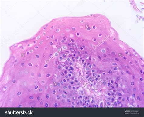 Histology Human Salivary Gland Tissue Show Foto Stock 693046081