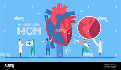 Cardiology Vector Illustration This Diseases Are Non Obstructive