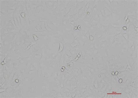 人卵巢癌细胞 Skov3（str鉴定正确） 细胞系 细胞库 旗赛生物科技（武汉）有限公司