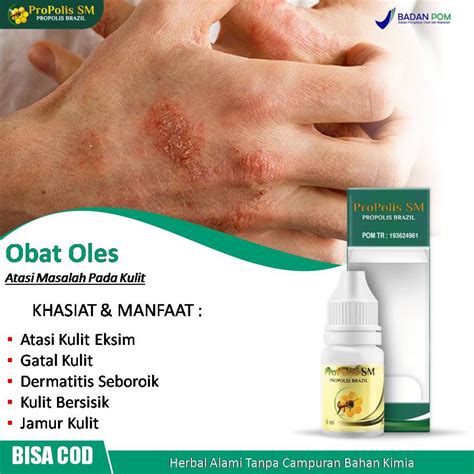 Jual Obat Eksim Kering Gatal Kulit Dermatitis Seboroik Kulit