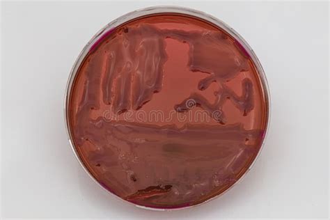 Bacterial Pathogen Colony Agar Streak Plate Medical Science Lab