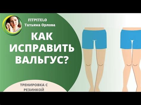 Вальгус стоп и коленей. 2 упражнения для исправления кривых ножек у ...