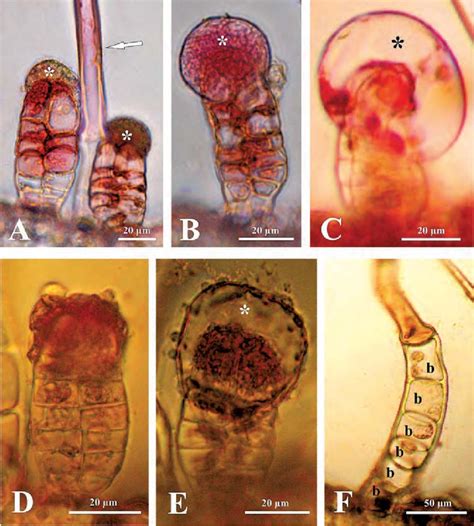 Glandular And Non Glandular Trichomes Of I Helenium After Applying