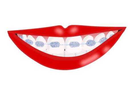 Teeth Braces Icon Dental Care Service Logo Caries Teeth Smile Vector ...