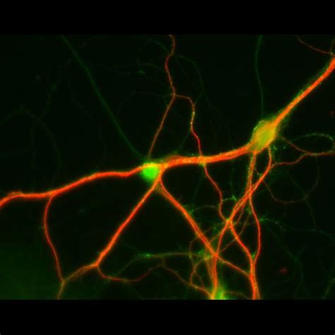 CIL:10404, Rattus, multipolar neuron. CIL. Dataset