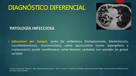 Lesiones Pulmonares Cavitadas Ppt