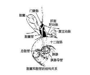 胆源性急性胰腺炎多图 39医疗图集 39健康网