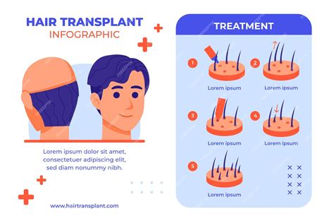 Free Vector Hand Drawn Hair Transplant Infographic