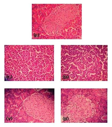 Figure1 Histopathological Evaluation Of Rats Pancreas Sections Normal Download Scientific