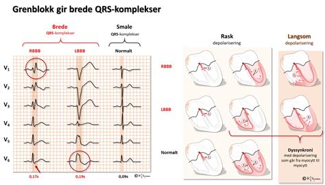 Index Of Elaring Fag Hjertesykdommer Spl Ekg Del Images