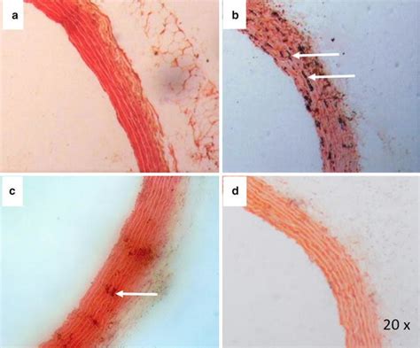 Histopathology Of Aorta Sections After Von Kossa Staining Observed At