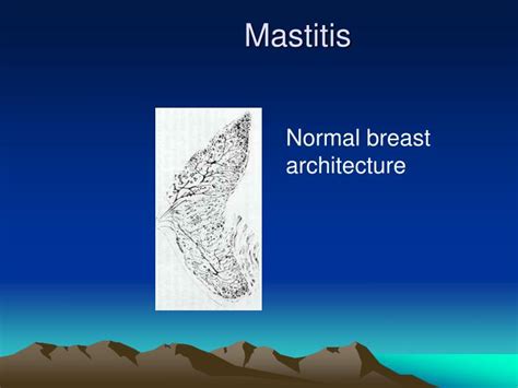 Ppt Mastitis Powerpoint Presentation Id1477352