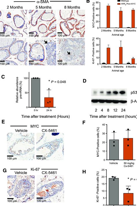 CX 5461 Inhibits Ribosomal DNA Transcription And MYC Driven Cell