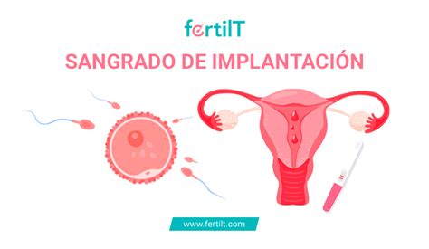 Sangrado de implantación qué es síntomas y cuánto dura