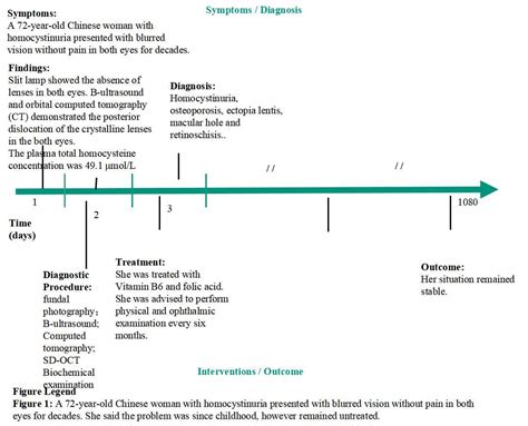 Case Report Spontaneous Bilateral Intraocular Lens Dislocation In A