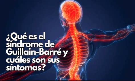 Qué es el síndrome de Guillain Barré y cuáles son sus síntomas