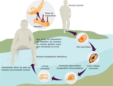 Esquistossomose O Que Ciclo Transmiss O Sintomas Tratamento