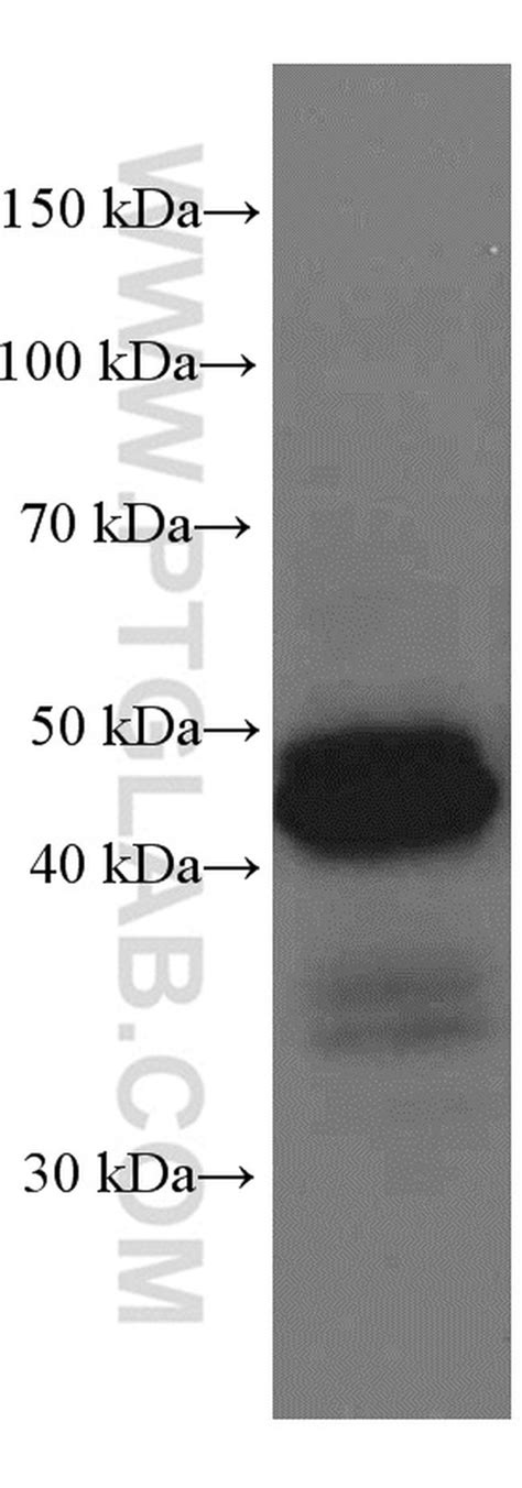 Hla Class I Abc Monoclonal Antibody 5c5b7 66013 1 Ig