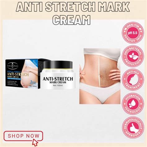 Aichun Beauty Anti Stretch Marks Cream Stretch Marks Repair Cream Scar