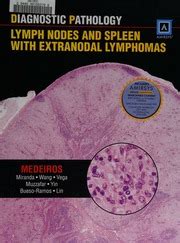 Diagnostic Pathology Lymph Nodes And Spleen With Extranodal Lymphomas