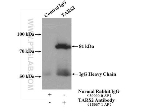 Tars Rabbit Anti Human Mouse Rat Polyclonal Proteintech L