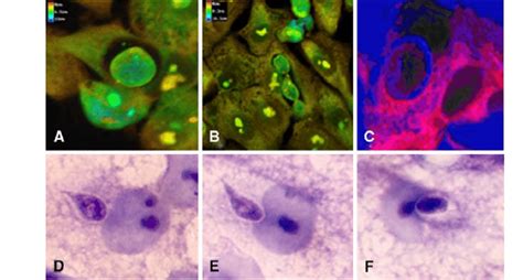 Invasion Process Of P Brasiliensis In Epithelial Cells After 8 H With