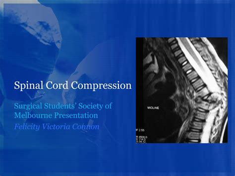 PPT - Spinal Cord Compression PowerPoint Presentation, free download ...